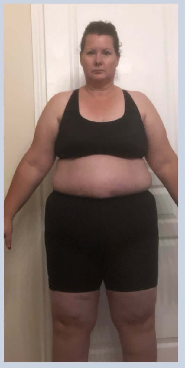 Patient 6's results after completing a Semaglutide weight loss treatment plan with Mr. Injection
